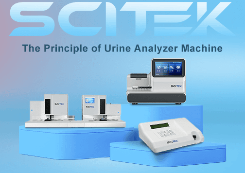 Urine Analyzer Machine: How Technology is Transforming Urine Testing