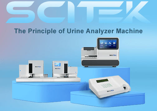 Urine Analyzer Machine: How Technology is Transforming Urine Testing